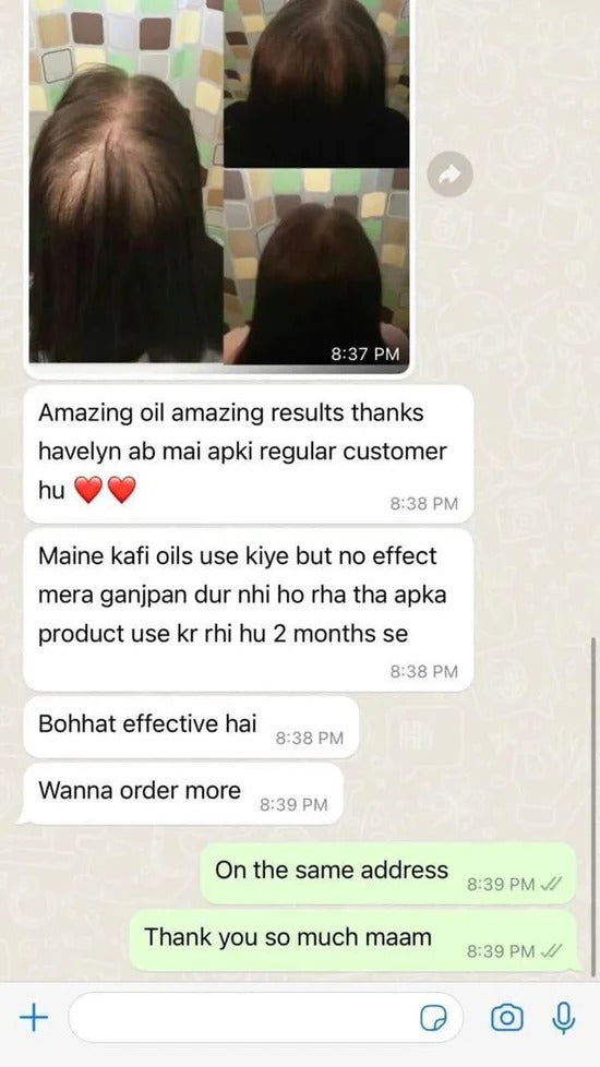 Havelyn Hair growth oil